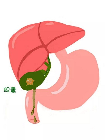 中医罗登祥院长讲解胆囊炎辨证治疗的方法