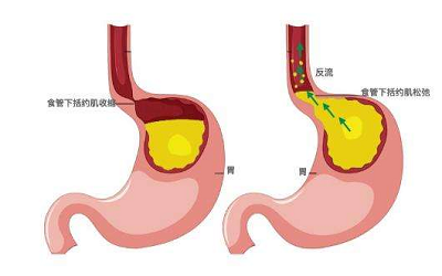 重庆御和堂中医|中医扶正治疗胃癌竟具有独特的结果