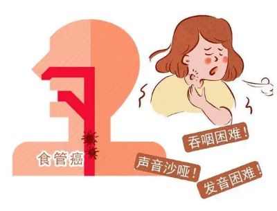 重庆中医治疗食管癌老中医:食管癌真可怕,竟然会遗传快来看看