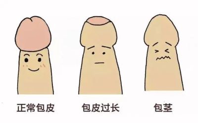 重庆中医肿瘤医馆排名|阴茎癌需要怎么注意,又该怎么治疗呢