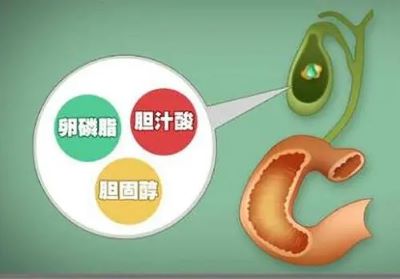 老中医石毓斌:恶心疲乏,这样的胆囊癌患者术后还能活多久？