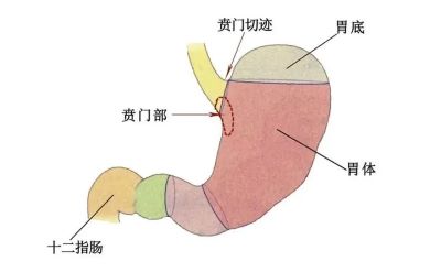 重庆中医肿瘤医馆科普|记住这些贲门癌各期症状才能更好的应对