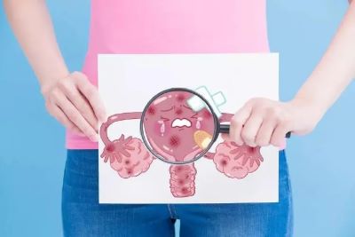 重庆中医医师罗登祥:女性健康的头号杀手“宫颈癌”离你究竟有多远