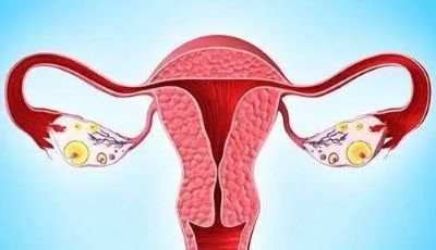 重庆老中医罗登祥:平时卵巢癌有什么症状?中医治疗卵巢癌的优势
